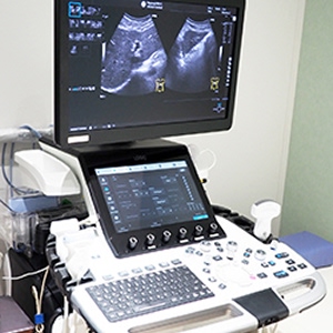 超音波画像診断装置写真